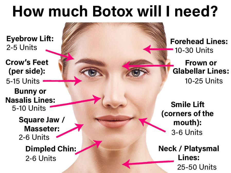 botox injections near me